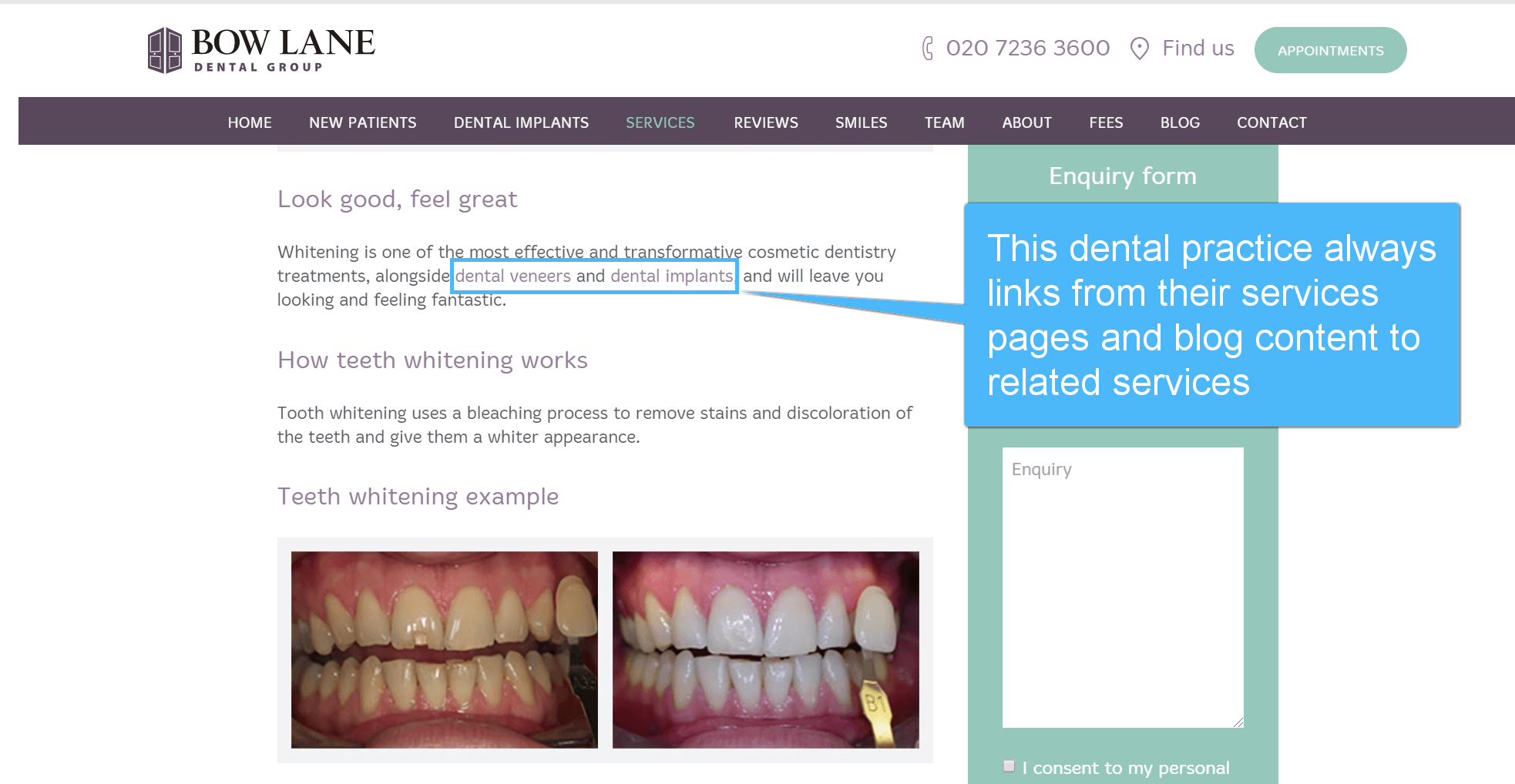 Przykład linku wewnętrznego na stronie internetowej kliniki dentystycznej